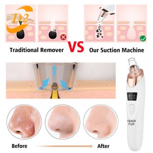 میکرودرم گلویش استایل مدل MF-76