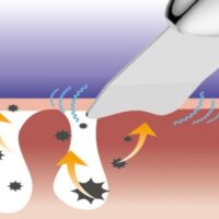 دستگاه پاکسازی پوست تاچ بیوتی مدل TB1769
