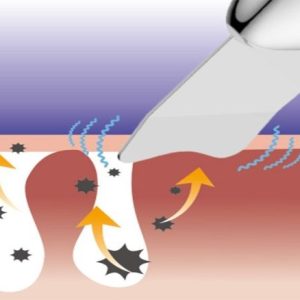 دستگاه پاکسازی پوست تاچ بیوتی مدل TB1769