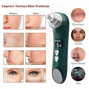 میکرودرم خانگی مدل BlackHead