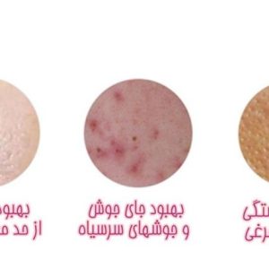 برس پاکسازی پاریس استایل مدل MT1