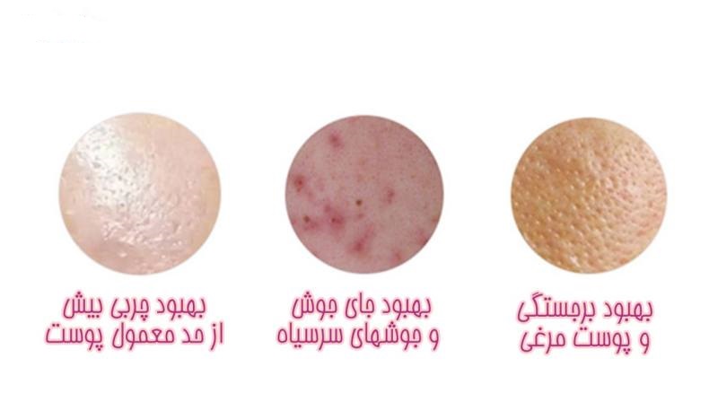 برس پاکسازی پاریس استایل مدل MT1 برس پاکسازی پاریس استایل مدل MT1