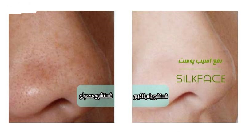 برس پاکسازی سیلکفیس مدل T202 برس پاکسازی سیلکفیس مدل T202