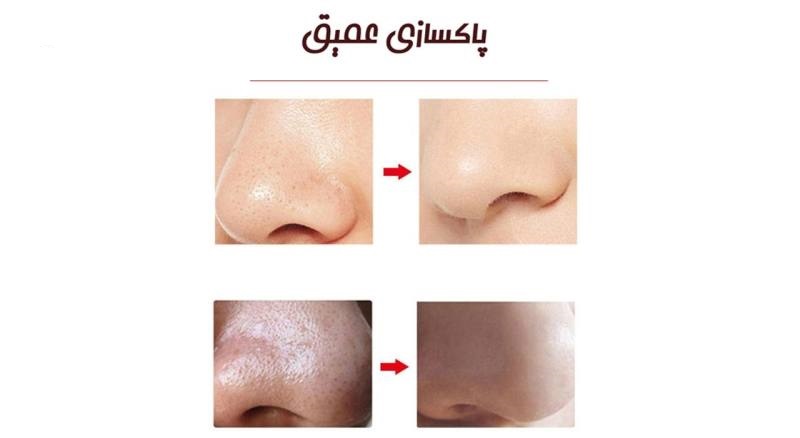 میکرودرم پاریس استایل مدل COMODO1 میکرودرم پاریس استایل مدل COMODO1