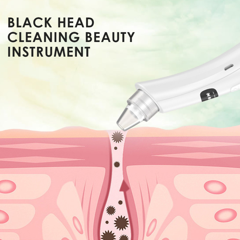 میکرودرم گلویش استایل مدل MT-84