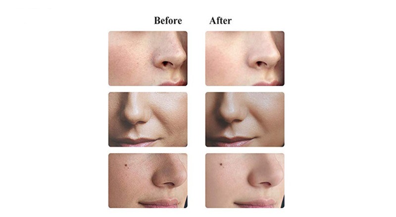 دستگاه پاکسازی صورت تاچ بیوتی مدل 1782 دستگاه پاکسازی صورت تاچ بیوتی مدل 1782