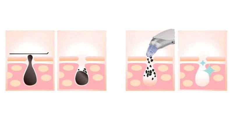 میکرودرم پاریس استایل مدل COMODO1 میکرودرم پاریس استایل مدل COMODO1